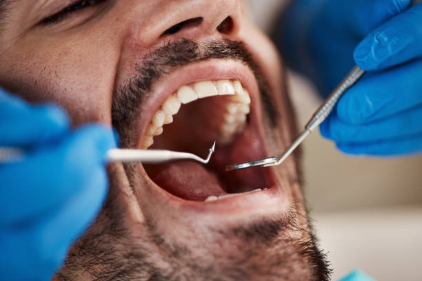Best Emergency Wisdom Teeth Removal in Lake Butler, FL